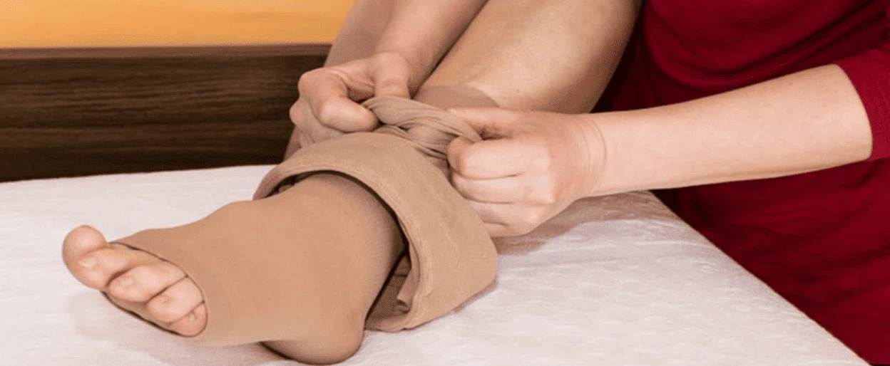 واریس پا چیست؟ بررسی علل، علائم + درمان 2 جوراب واریس پا